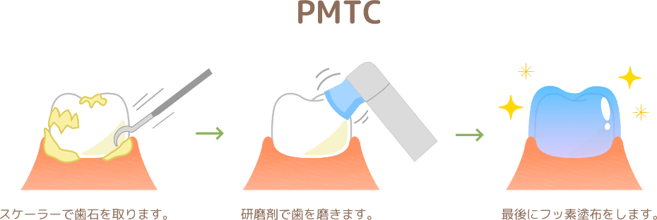 PMTCの説明